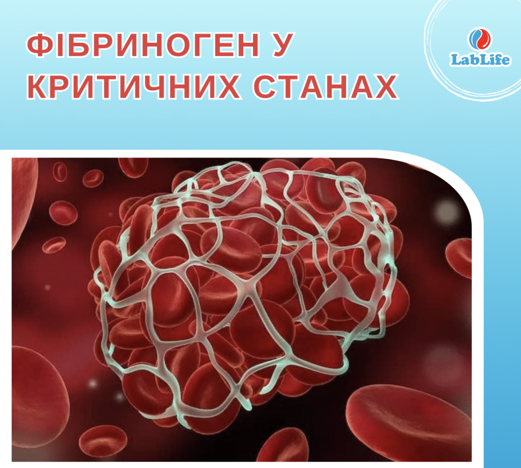 Фібриноген у критичних станах, фото №1